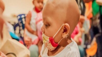 تطوير تقنية سريرية لعلاج أورام الدماغ لدى الأطفال 17 0 3068