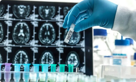 روسيا تعد العالم “بلقاح ثوري” للسرطان في يناير المقبل 1 00 63