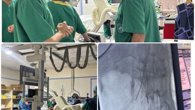 مستشفى المشرق يحقق إنجازًا طبيًا تاريخيًا: أول عملية TIPS معكوسة لانسداد الأوعية الكبدية والوريد البابي 2 1 3732