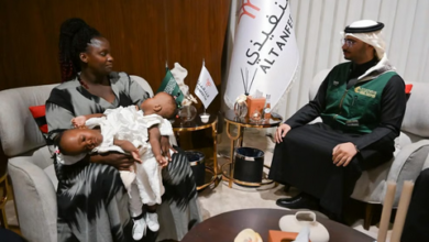 وصول التوأم التنزاني الملتصق نانسي ونايس إلى الرياض لفحصهما طبياً 2 22 118