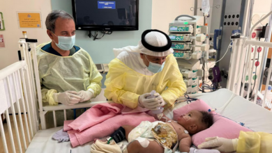 الربيعة: استقرار حالة التوأم الصومالي «رحمة ورملا» بعد 4 أيام من فصلهما 2 4444 74