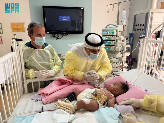 الربيعة: استقرار حالة التوأم الصومالي «رحمة ورملا» بعد 4 أيام من فصلهما 1 4444 74