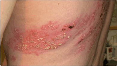 الخضيري يحذّر: مناعة الحزام الناري قد لا تستمر أكثر من عامين 2 888 2 10