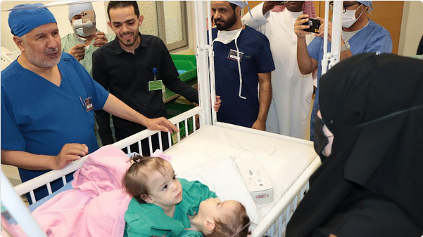 بعد قليل.. انطلاق عملية فصل التوأم السيامي السوري "سيلين وإيلين" بالرياض 1 888 74