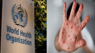 طفرة جينية هجينة.. رصد سلالة جديدة من "جدري القرود" تجمع بين متحورين في بريطانيا والهند 5 999 2 30